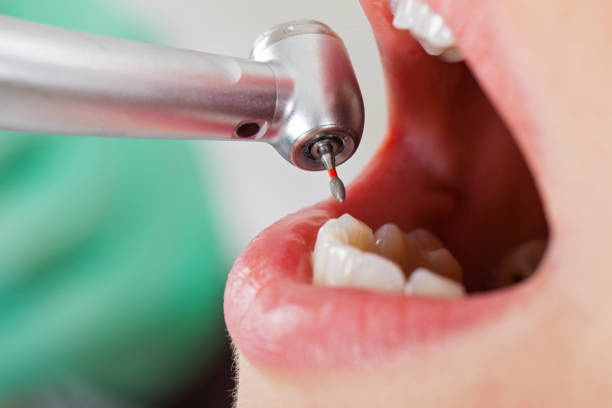 Best Pediatric Emergency Dentist in Lutz, FL